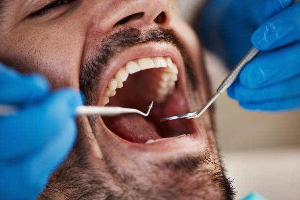 Best Pediatric Emergency Dentist in Milton, WI